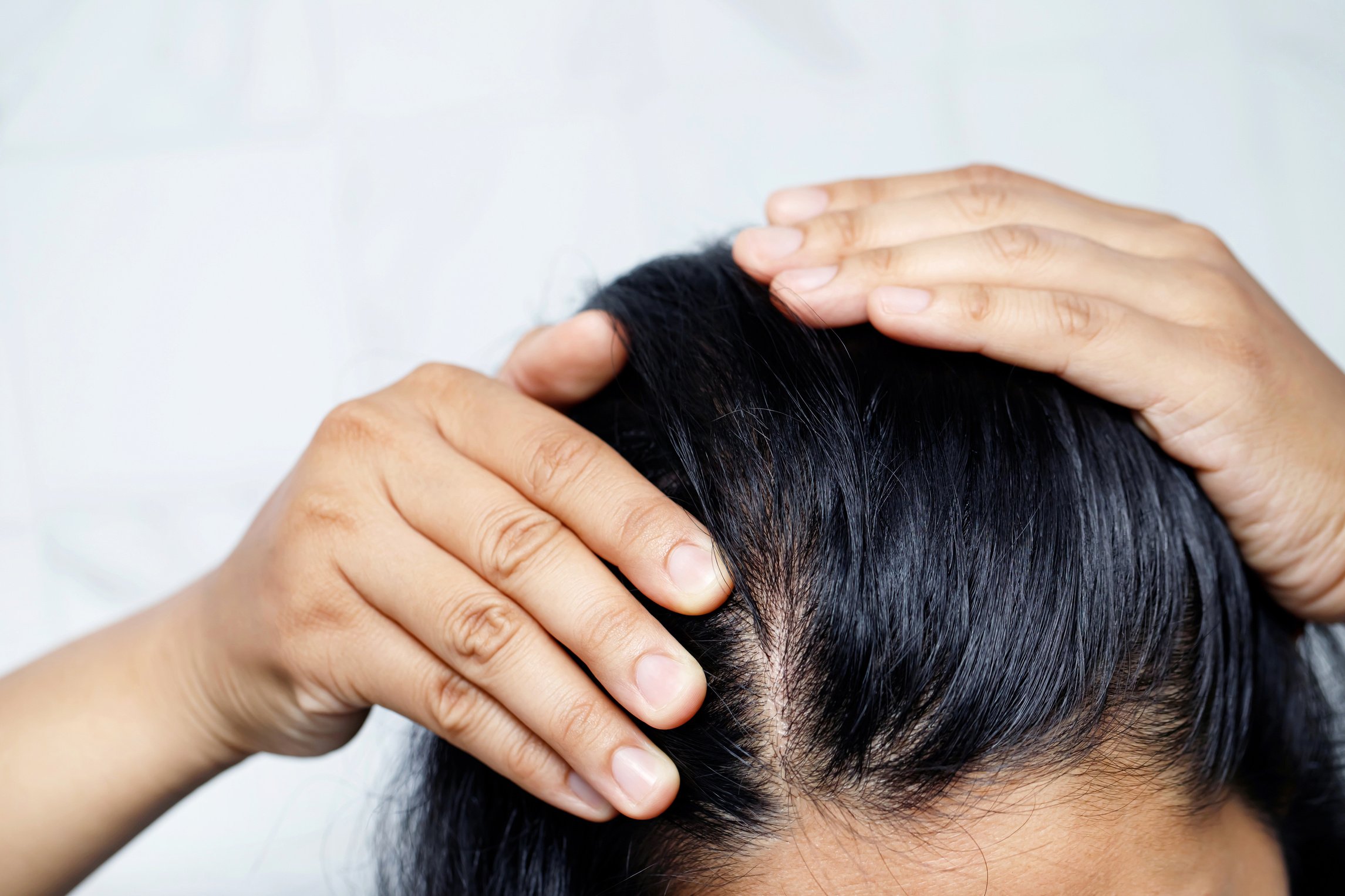 Woman Experiencing Hair Loss          